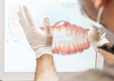 Impronta Dentale Digitale